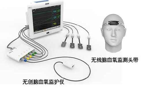 中科院自动化所科技成果落地转化产品“无创脑血氧监护仪”取得医疗器械注册证