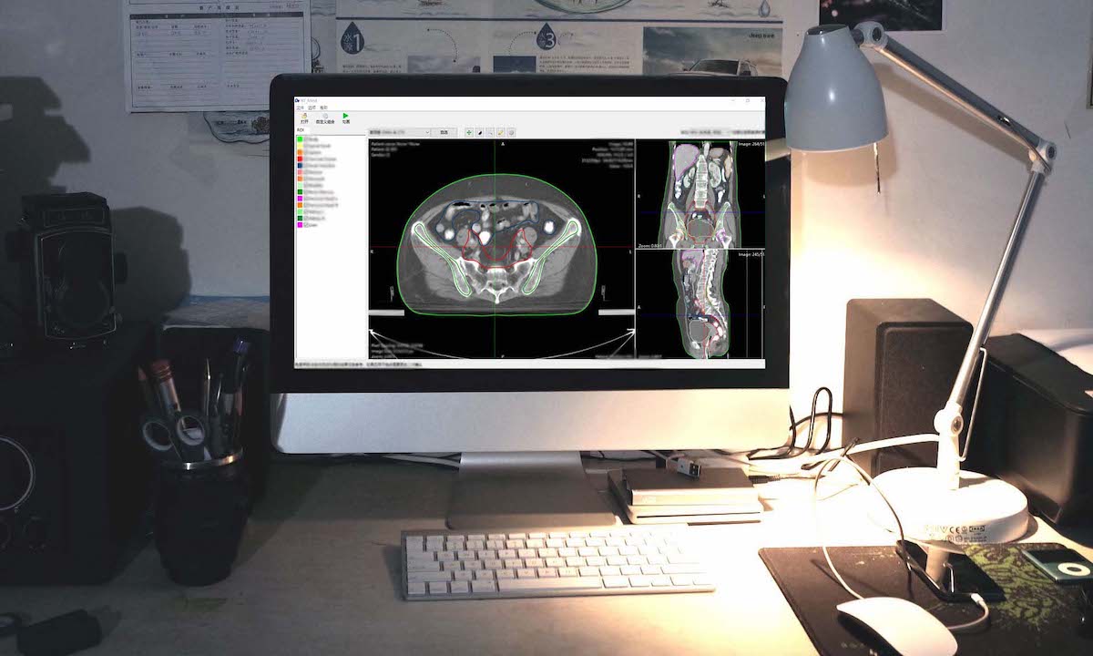 人工智能肿瘤治疗服务商“医智影科技”完成数千万元Pre-A轮融资