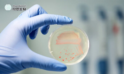 国投聚力独家投资，慕恩生物完成3亿元C+轮融资